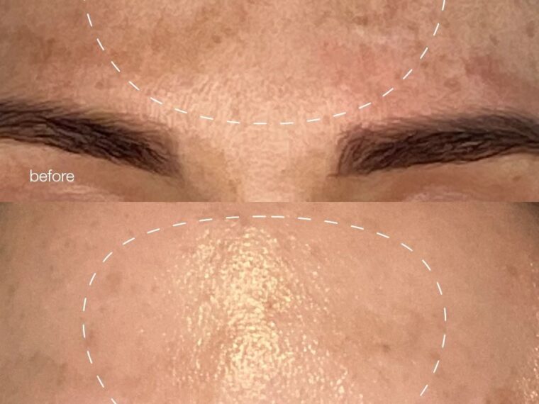 Dermalogica Melanopro