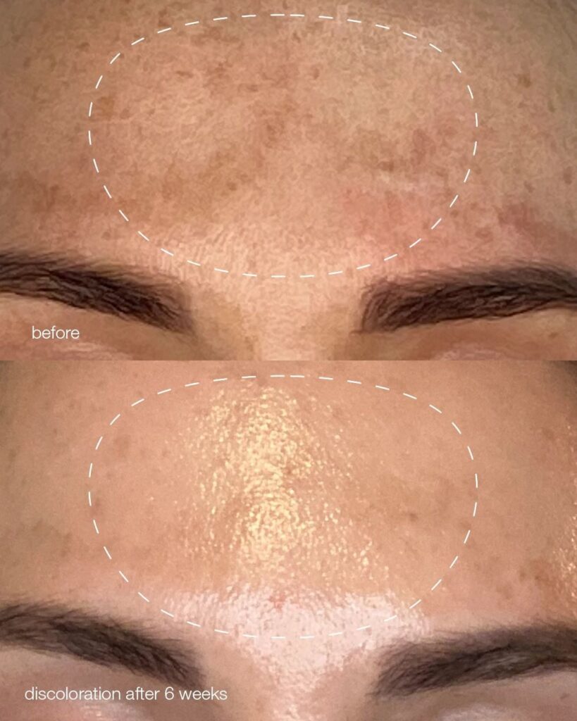 Dermalogica MelanoPro