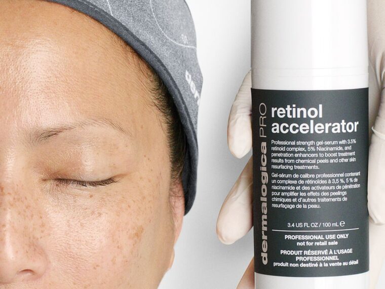 Pro Retinol Peel